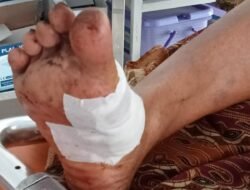 Monyet Liar Berulah! Dua Warga Desa Pakusari Jember Dibikin Masuk RS